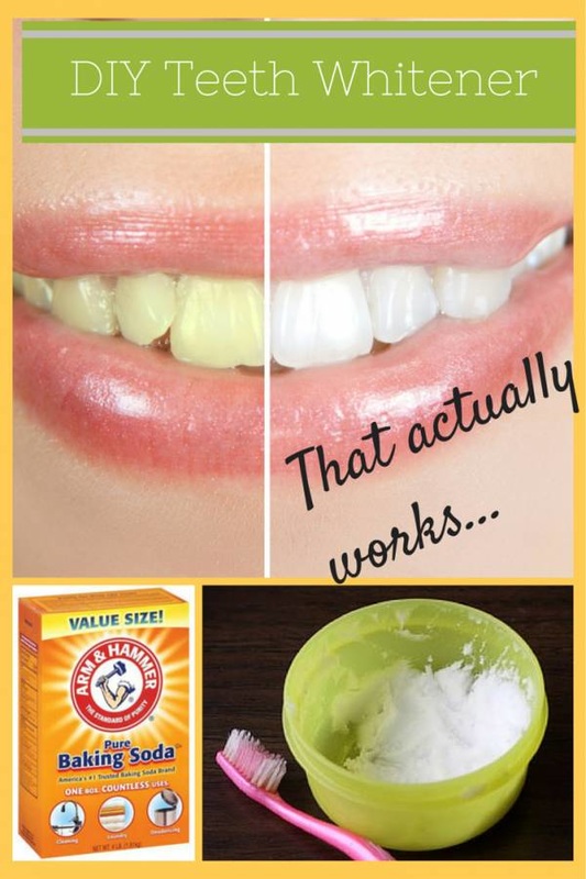 teeth whitening tips and tricks